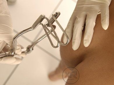Anal Spreader