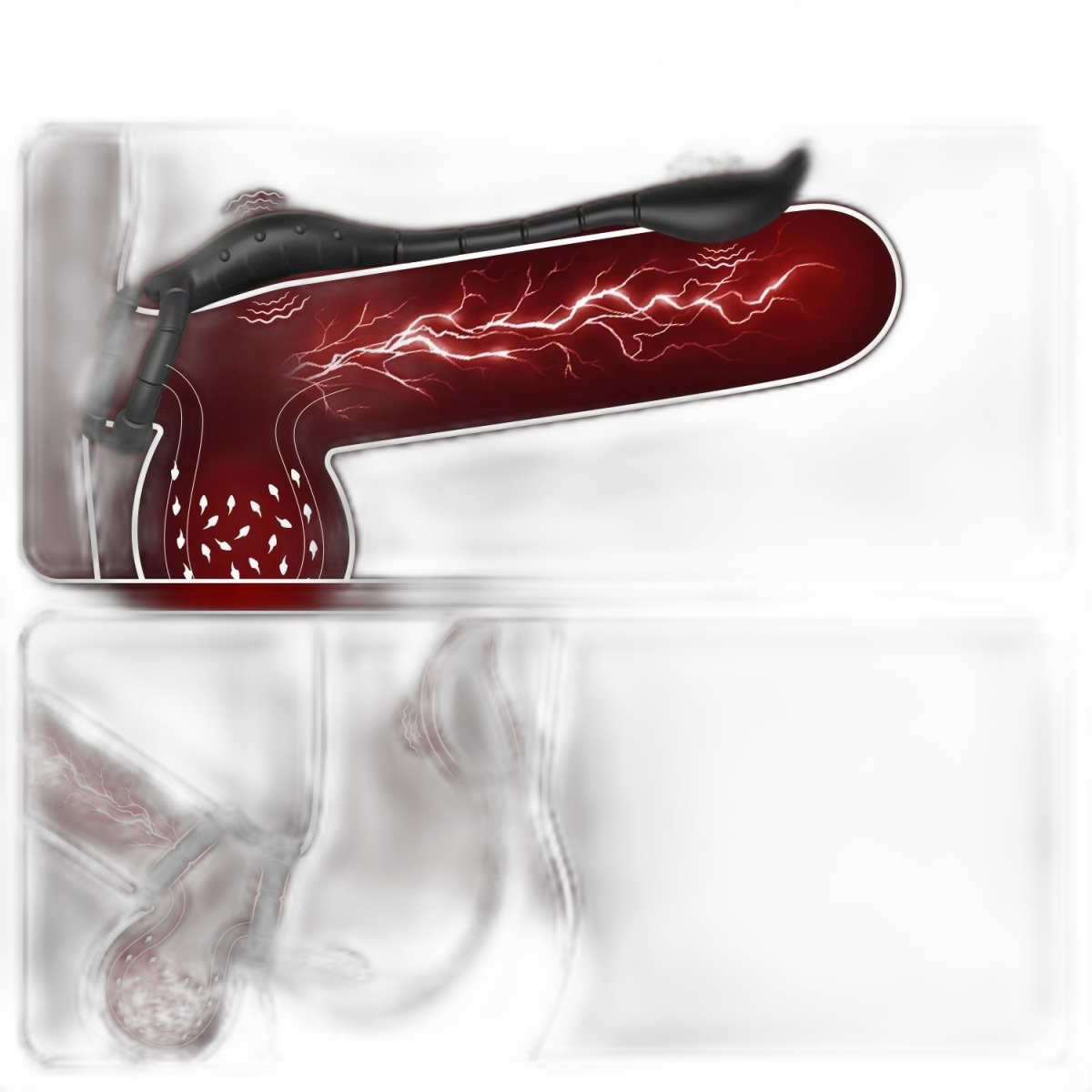 Prostate Massager Cock Ring