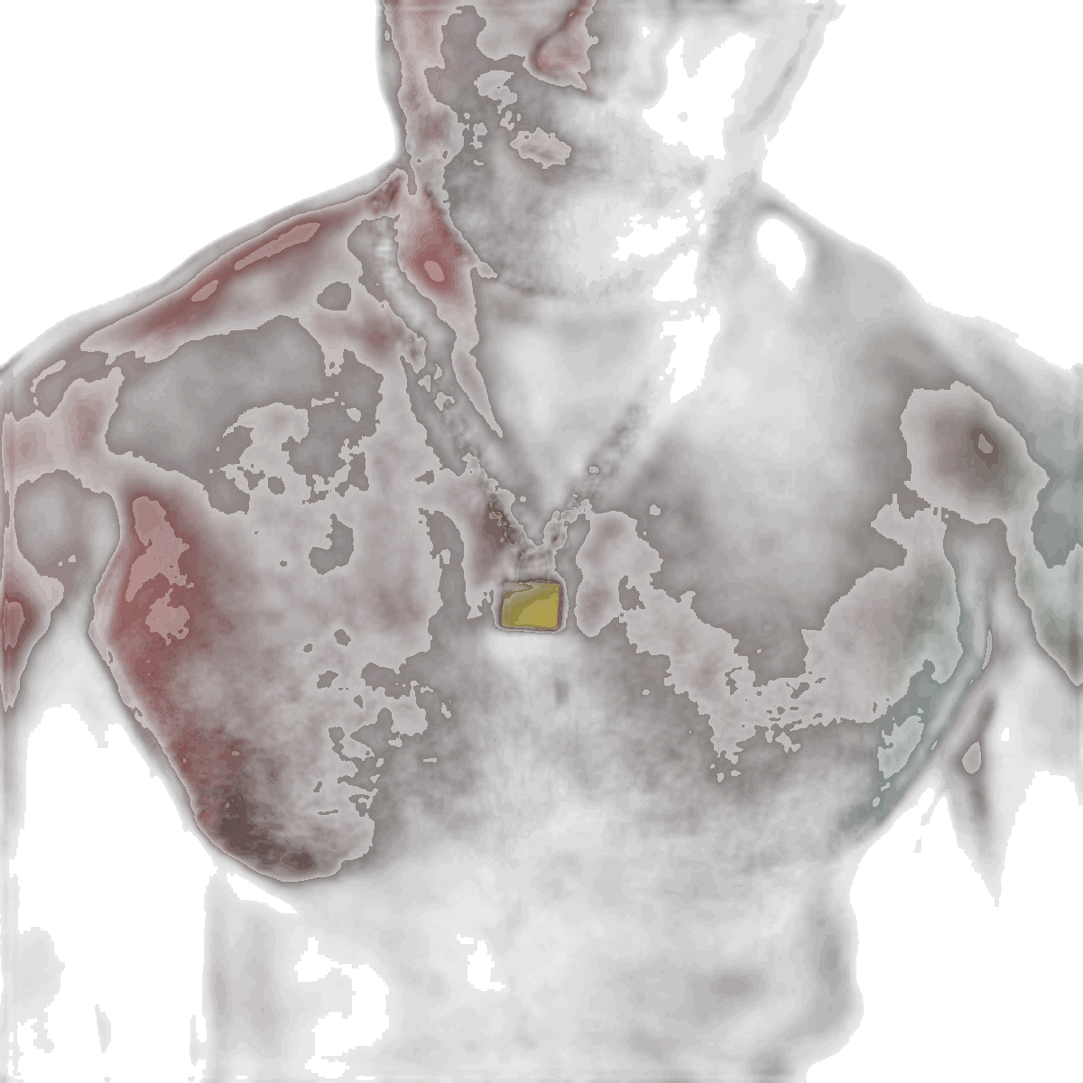 FKME Collar And Lock