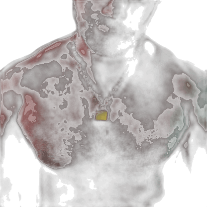 FKME Collar And Lock