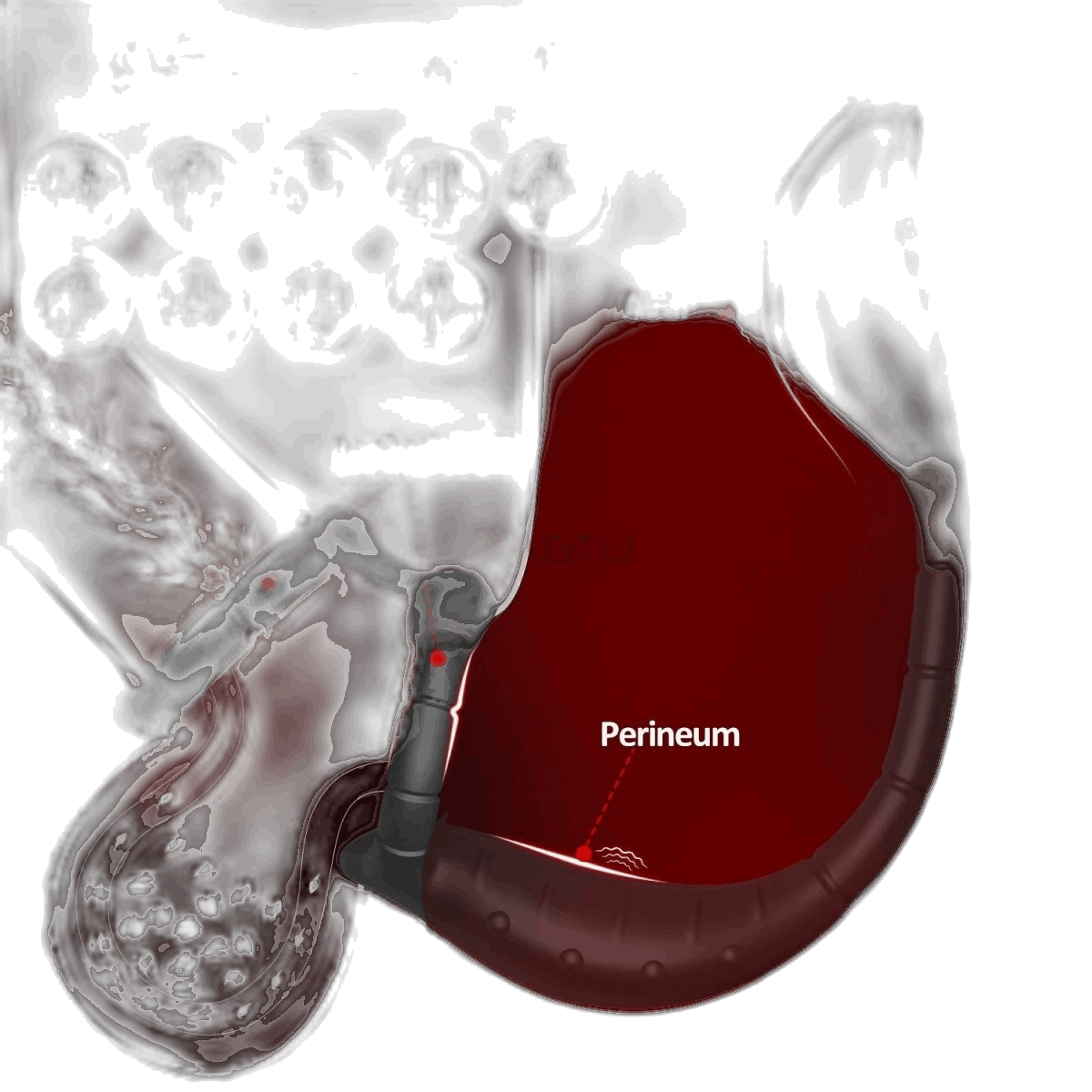 Prostate Massager Cock Ring