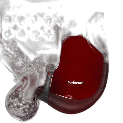 Prostate Massager Cock Ring