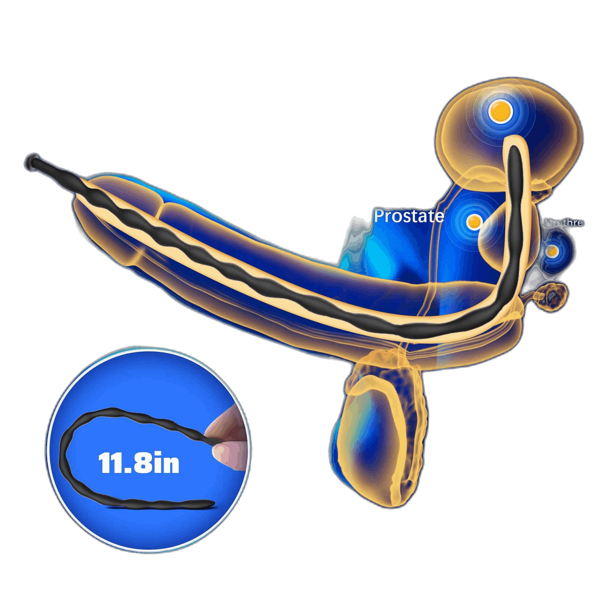 Ribbed Silicone Urethral Sounding Set - 8 Pcs