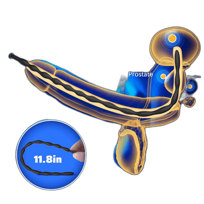 Ribbed Silicone Urethral Sounding Set - 8 Pcs