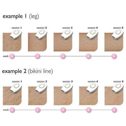 Femboy IPL Hair Removal Device